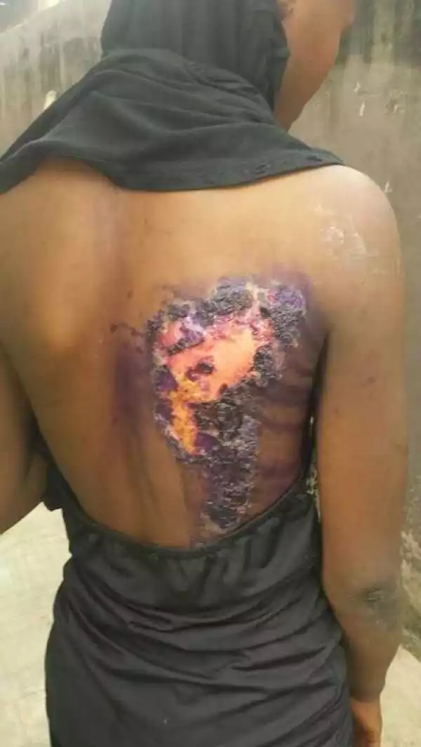 Wicked Soul!! See What Woman Did To Her Step-Sister With Hot Iron (Photo)